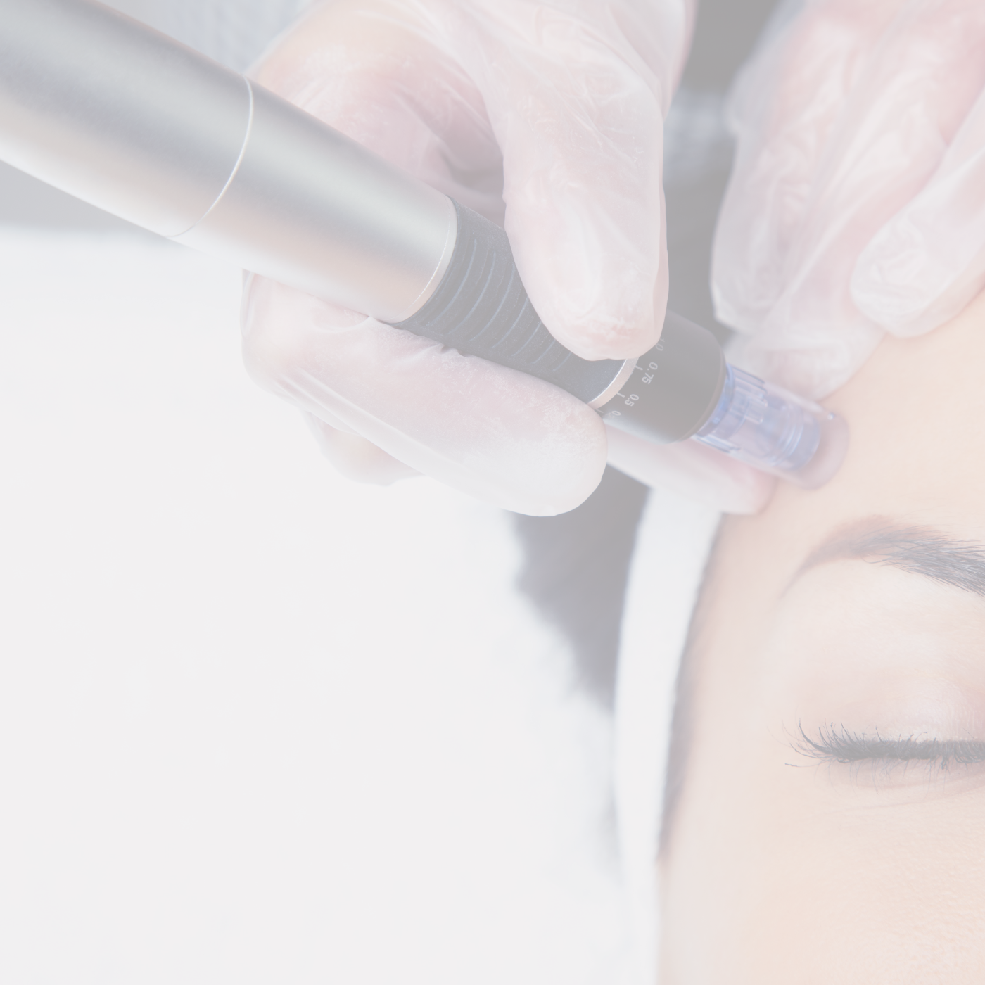 lasting lines - Kosmetikstudio - Microneedling