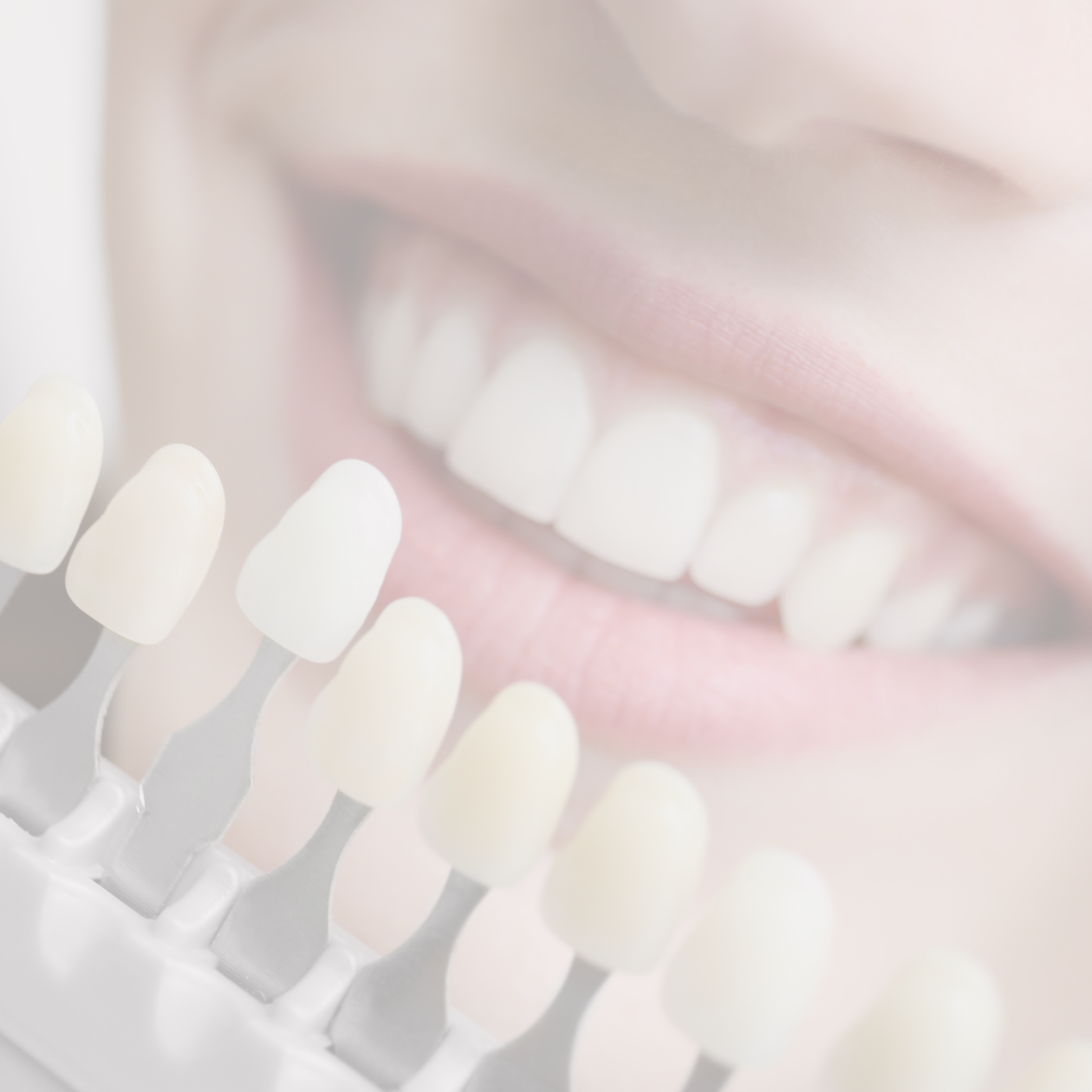 lasting lines - Kosmetikstudio - kosmetische Zahnaufhellung